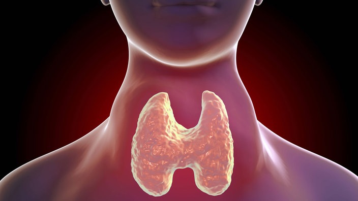 Das Bild zeigt eine Grafik, auf der eine Schilddrüse zu sehen ist.