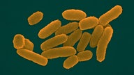 Pestbakterium Yersinia pestis