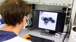 Virus Mpox auf einem Bildschirm