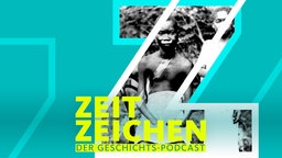 Die Amputation wurde zur Bestrafung von Arbeitern im Kongo-Freistaat eingesetzt, der bis 1908 von Leopold II. von Belgien kontrolliert wurde.